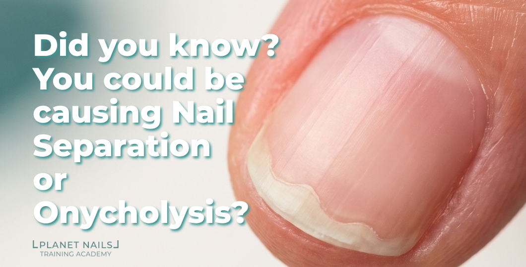 Close-up of a fingernail with separation starting at the free edge