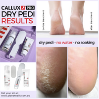 Callux Pro Dry Pedicure Set