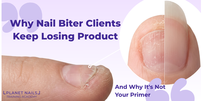 Why Nail Biter Clients Keep Losing Product